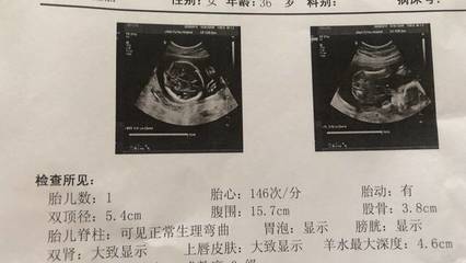 胎儿双顶径标准看男女