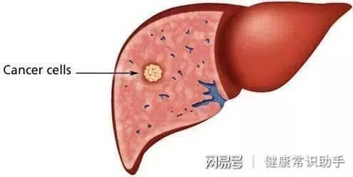 肝功能高是怎么回事