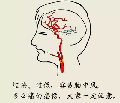 脑梗怎么治疗