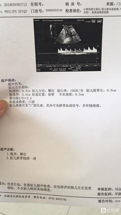 37周肱骨长多少