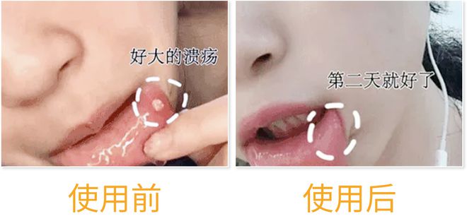 口腔里发涩是怎么回事