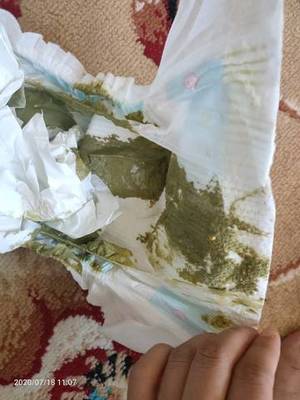 拉的粑粑是绿色的怎么回事
