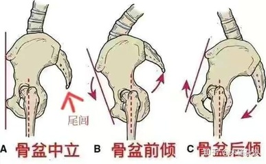 尾巴骨大是怎么回事啊