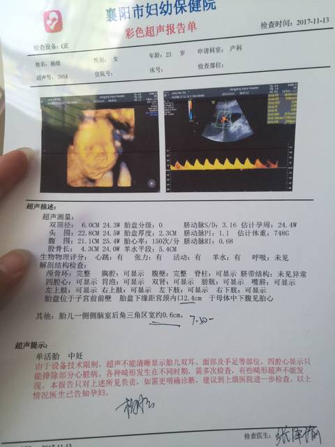 胎儿侧脑室宽的发生率有多少钱