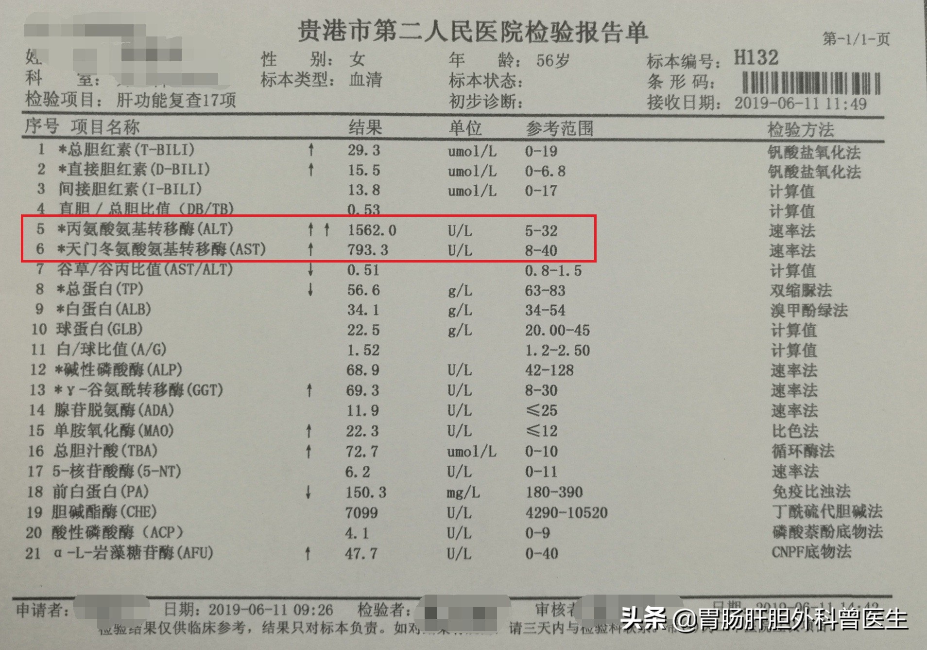 肝脏转氨酶偏高是怎么回事