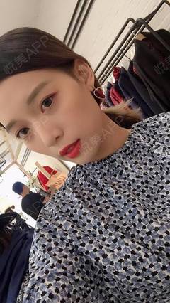 玻尿酸后期肿胀怎么办
