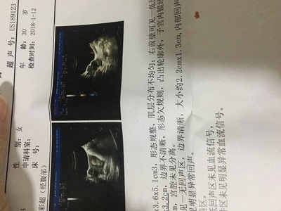 怎么样怀孕几率大