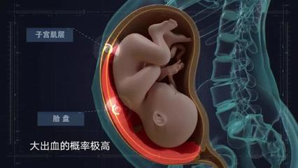 刚怀孕下面出血