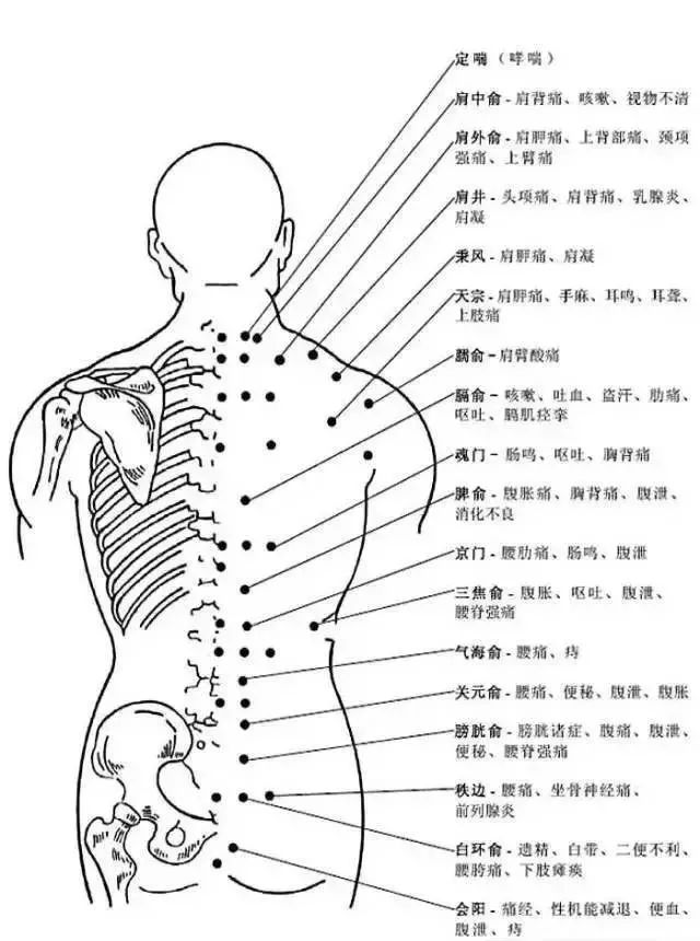肩中俞疼是怎么回事