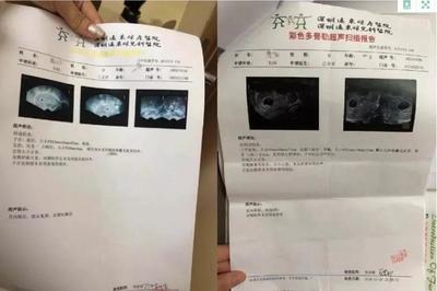 一直戴套还是怀孕了