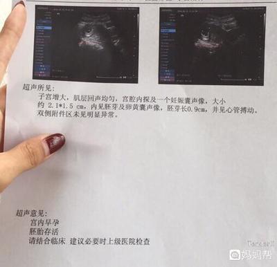 孕酮低胎儿发育正常