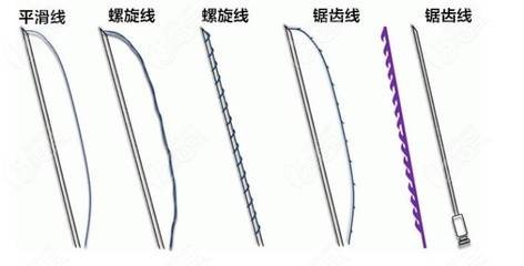 做进口埋线多少钱