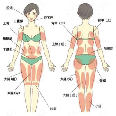 手臂抽脂需要多少钱