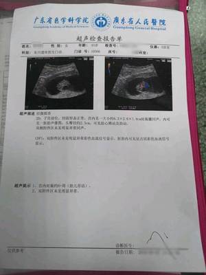 刚怀孕一周会恶心吗