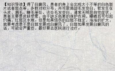 孕妇可以擦药膏吗