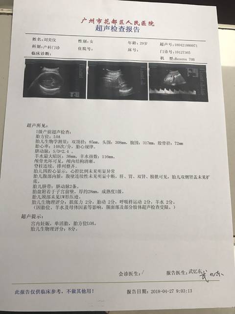 37周宝宝发育标准