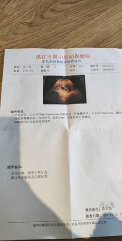 怀孕几个月可以看到胎心