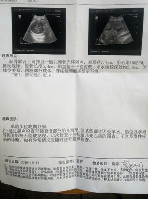胎儿七个月双顶径标准