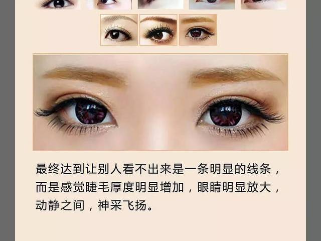 内眦赘皮双眼皮