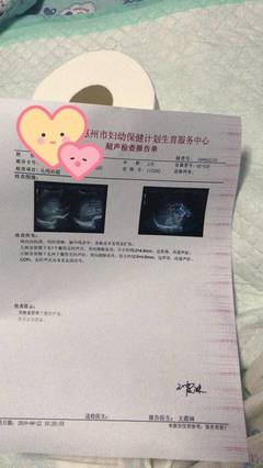 双侧囊肿怎么算