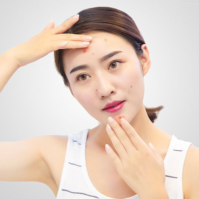 红痘痘怎么治