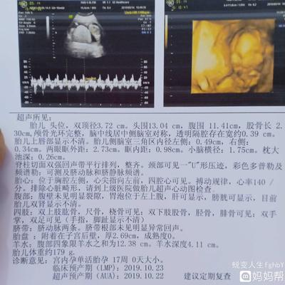 怀孕四个半月胎儿有多大