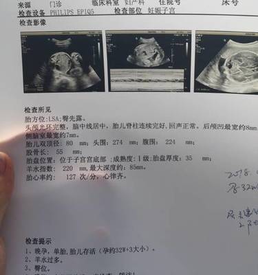 胎儿照片大全集32周