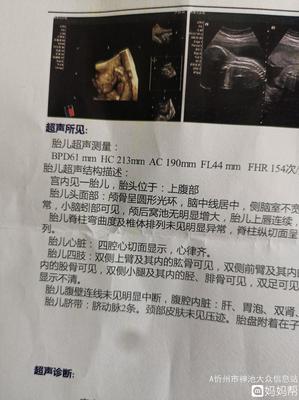 四维彩超几个月最合适