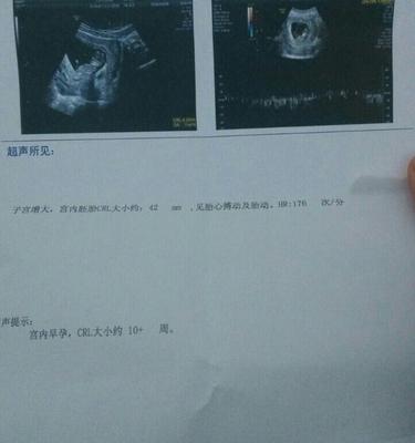 怀孕十一周胎儿会动吗