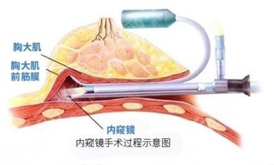 奥美定多少钱