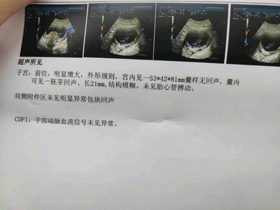 两个月没有胎心