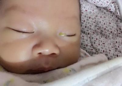 满月宝宝舌苔厚白是怎么回事