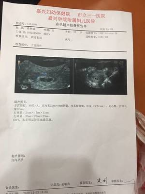 怀孕40天能看出男女吗
