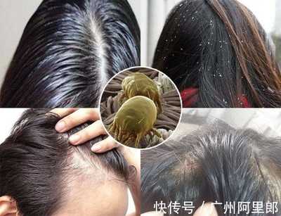 染发后怎么洗头