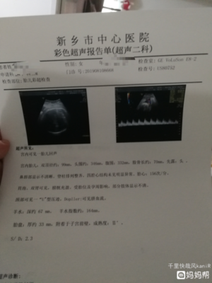 宝宝做核磁共振