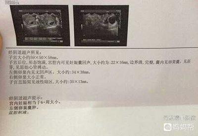 输卵管有积液是怎么回事