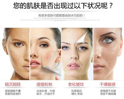 痘痘皮肤 该怎么蒸脸