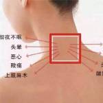 胳膊一直麻是怎么回事