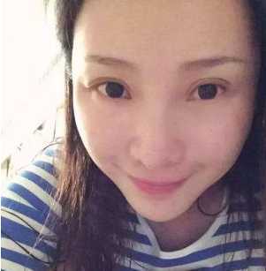 双眼皮上面又条折痕