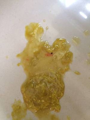 宝宝一天拉三次大便有点稀薄