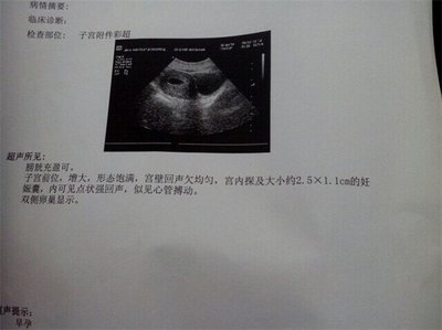 怀孕检测报告单