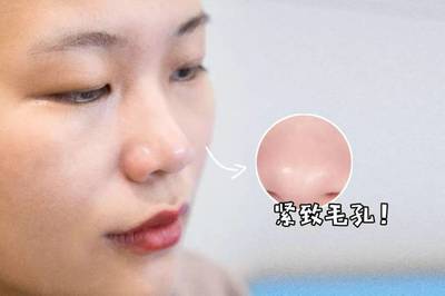 做完小气泡可以化妆吗