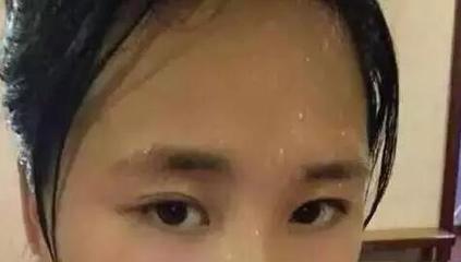 额头总出汗是怎么回事
