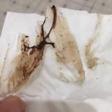 排卵期咖啡色白带