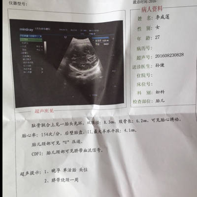 孕三十三周是几个月