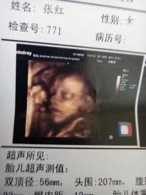 胎儿24周是几个月