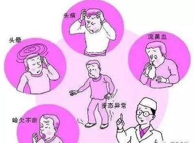 瞬间晕厥是怎么回事