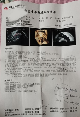 巧克力囊肿手术后多久可以怀孕