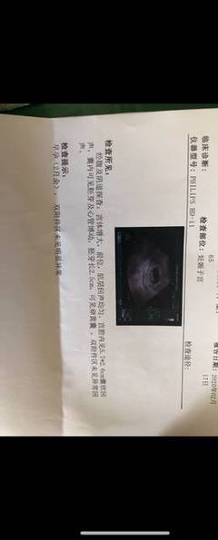 刚怀孕见红孕酮正常怎么回事