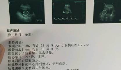 胎儿双顶径标准看男女